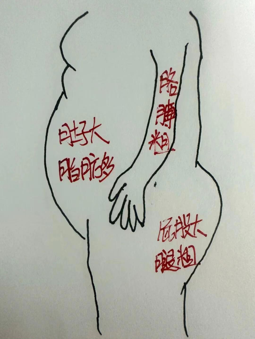 在中医理论中，甲减（甲状腺功能减退症）导致的肚子变大，通常与以下几个方...