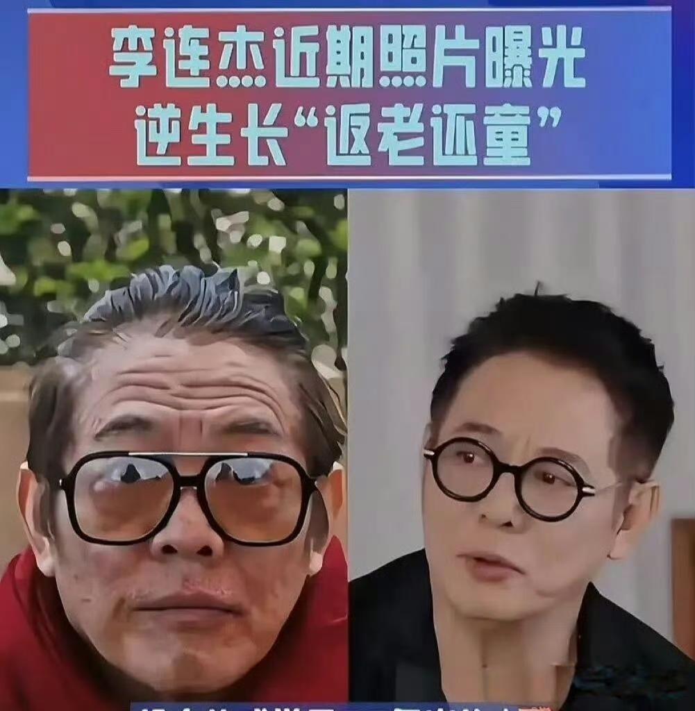李连杰“返老还童”，绝对判若两人。网上流出换💞换血扑朔迷离，自己赤身亮相辟谣换