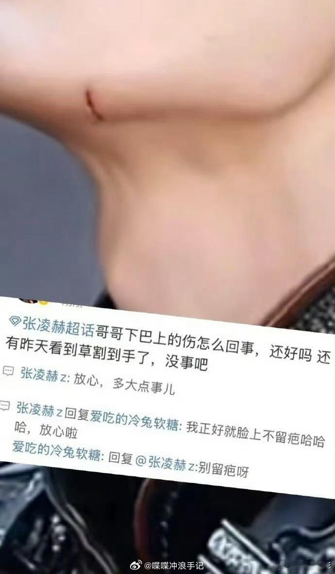 张凌赫回应粉丝下巴受伤  张凌赫回应下巴的伤  张凌赫也太好了吧 