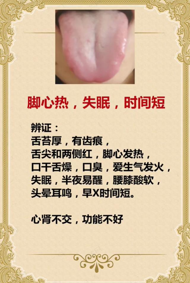 脚心发热、失眠易醒？多半是心肾不交，影响身体状态