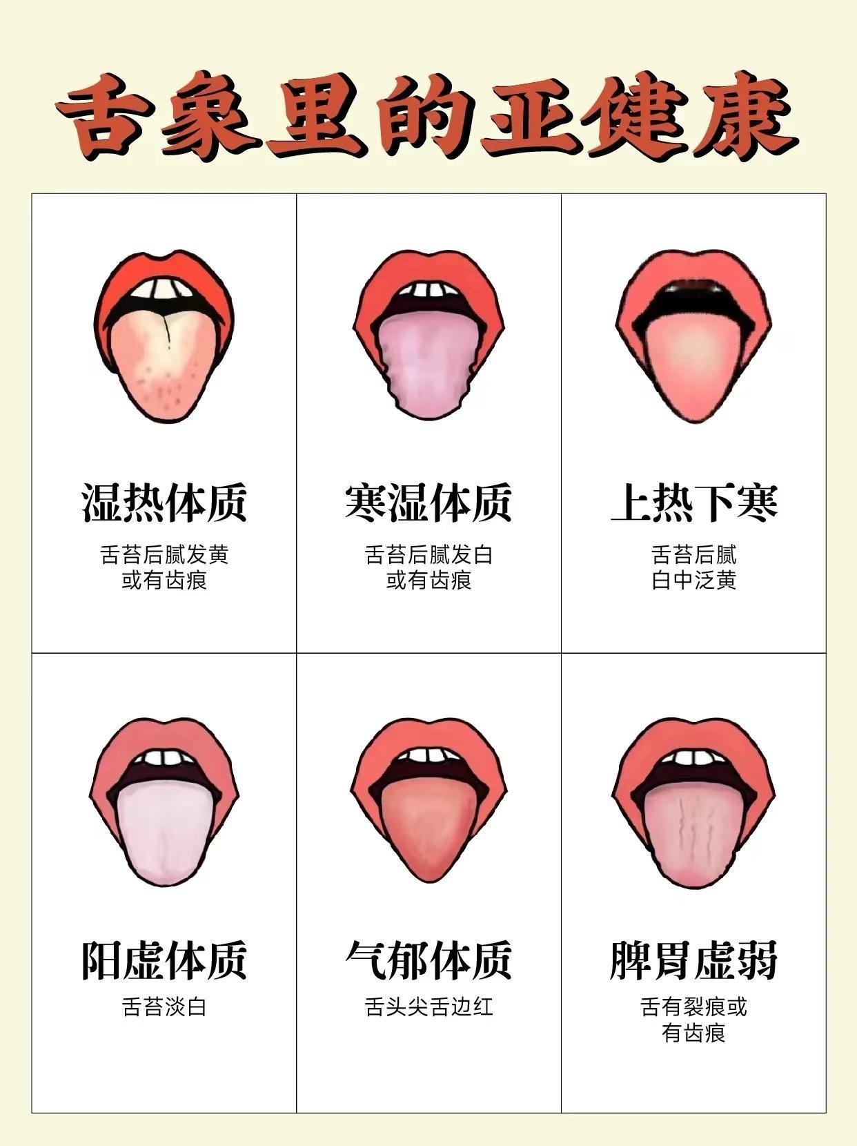 小小的舌苔对应着，五脏六腑
今天教大家怎么了解自己的身体健康

[一R]寒湿者
