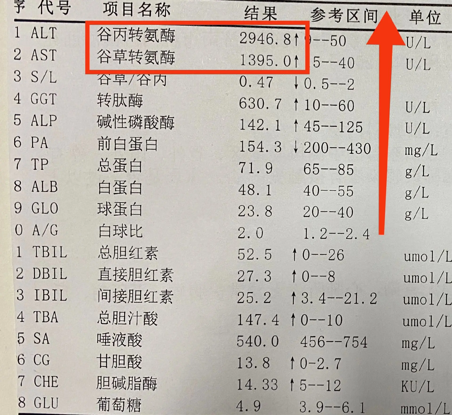 肝功能这项指标升高一种不用管，一种必须治！ 转氨酶分为谷丙转氨酶和谷草...