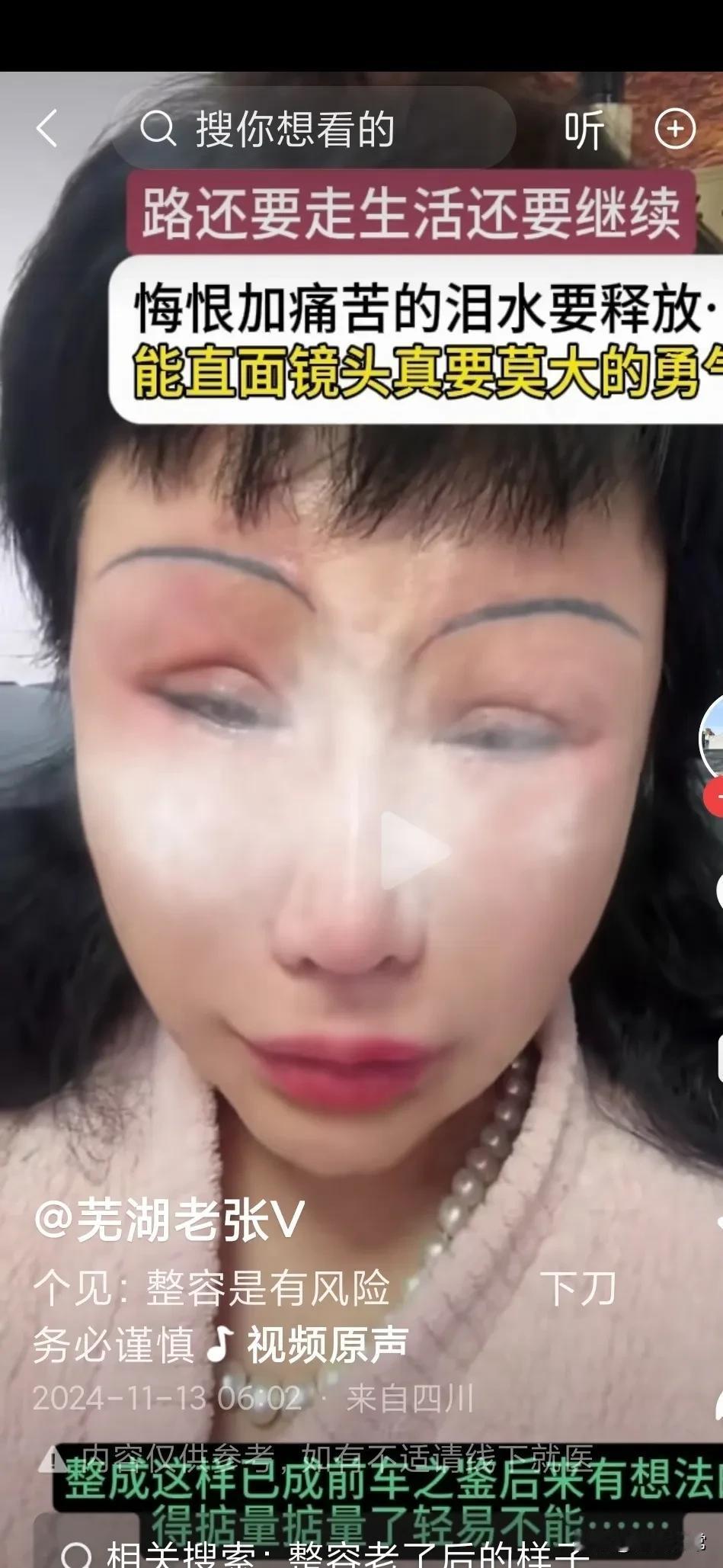 整容的惨状，真的不明白，有些女人，明明自己已经就长得很漂亮，很好看的了，还是因为
