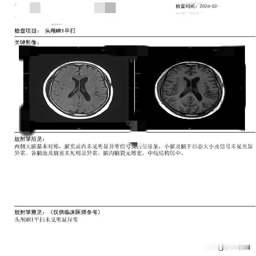 核磁报告“未见异常”，可我却高兴不起来！
       我的脑瘤呢？不会凭空消失