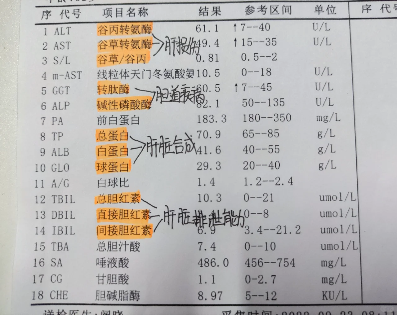 肝功能这个数值升高非常严重！ ①谷丙谷草同时升高，谷草大于谷丙，说明有...