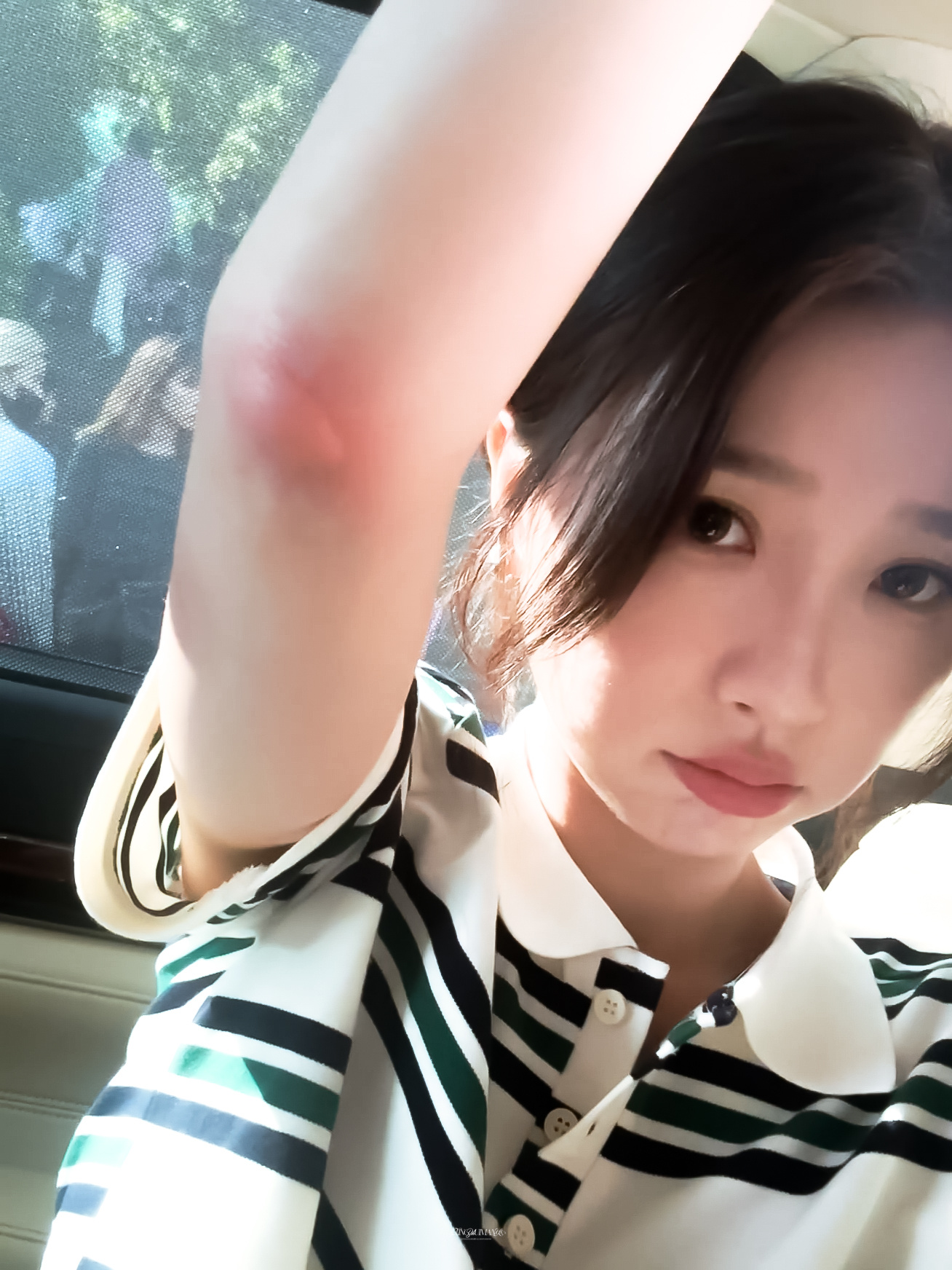 可恶的蚊子怎么可以咬小猪！ 