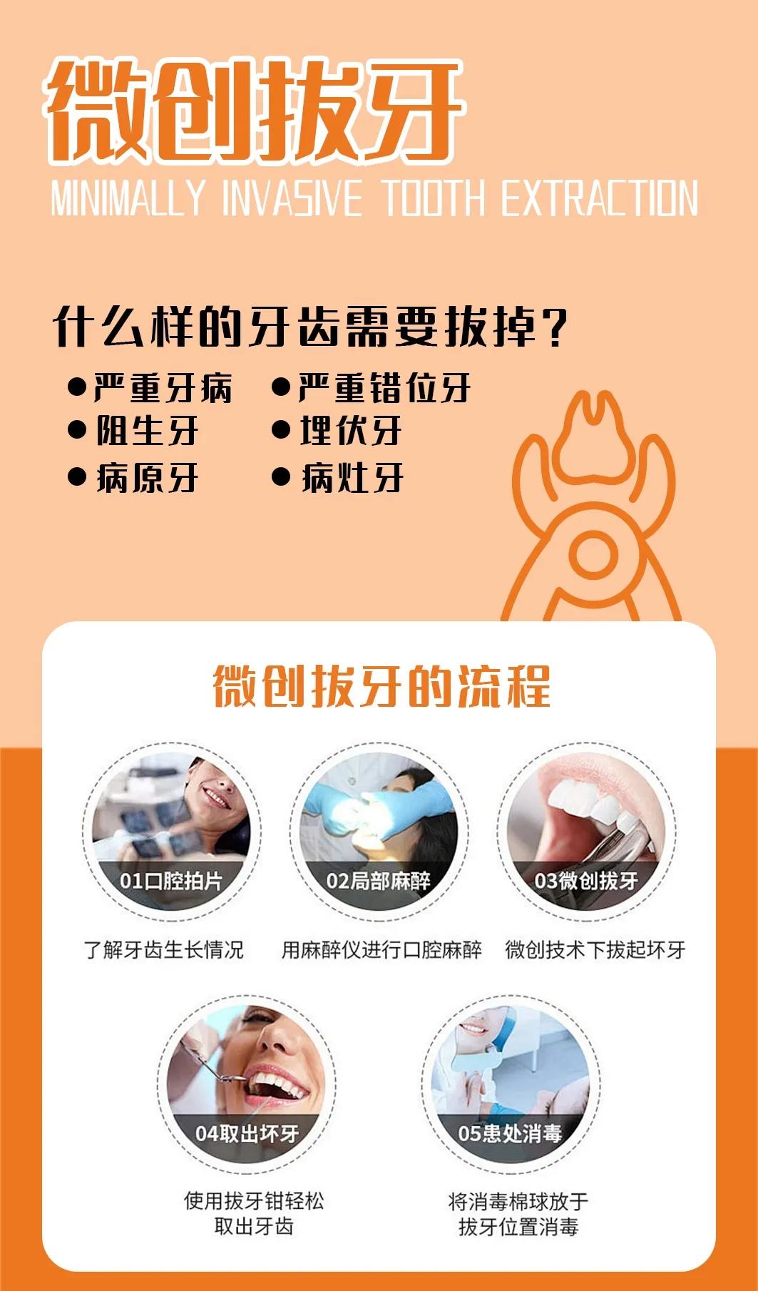 微创拔牙的优点是什么