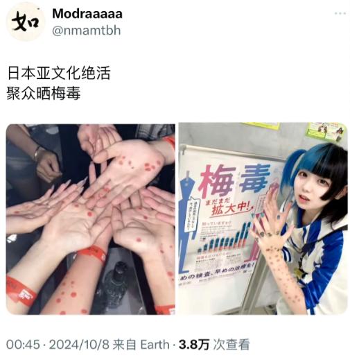 震惊！日本年轻人竟疯狂“炫耀”梅毒？25岁以下感染者暴增800%！专家惊呼：这是