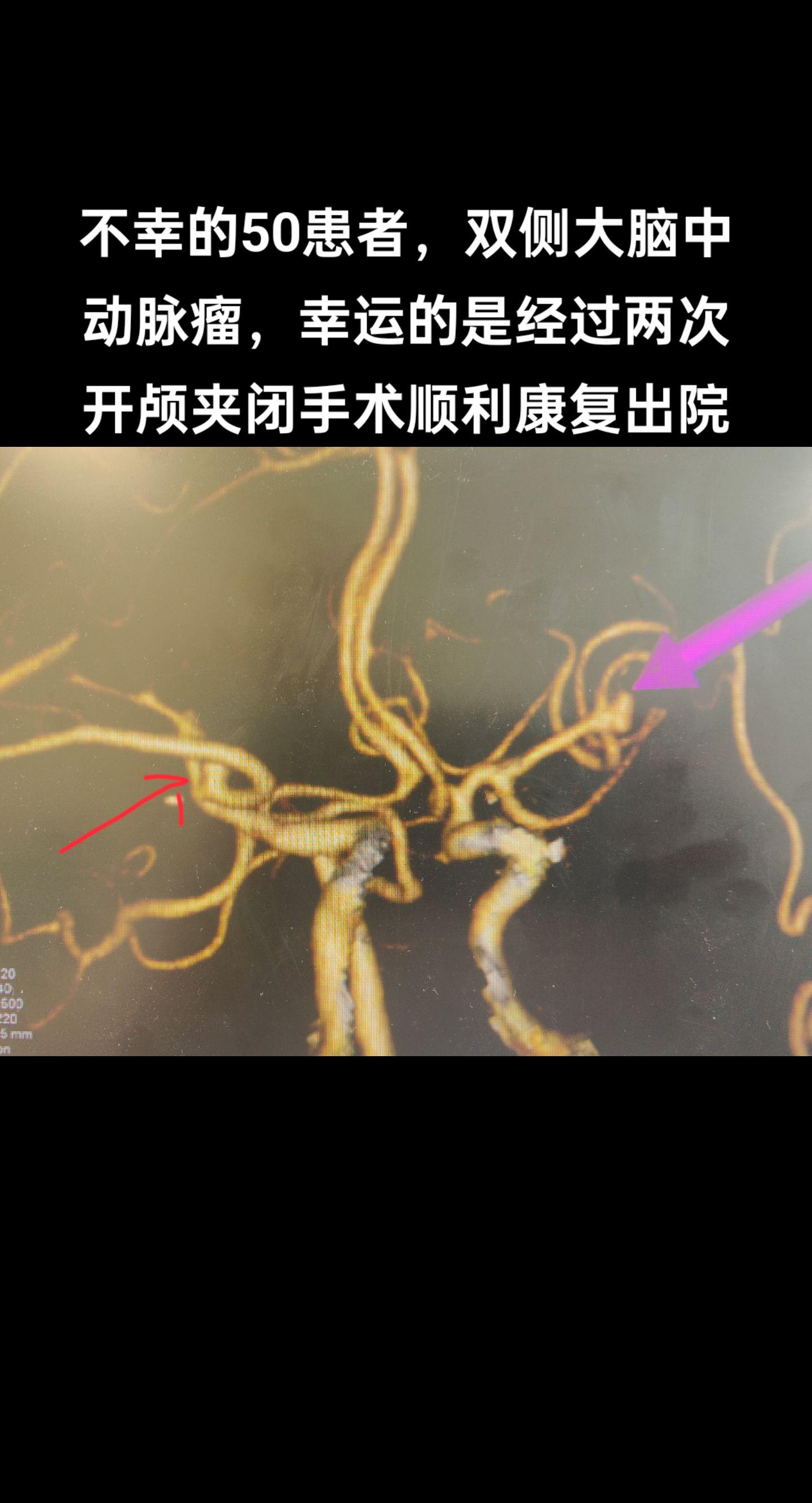 医学科普 手术室日常 医路前行