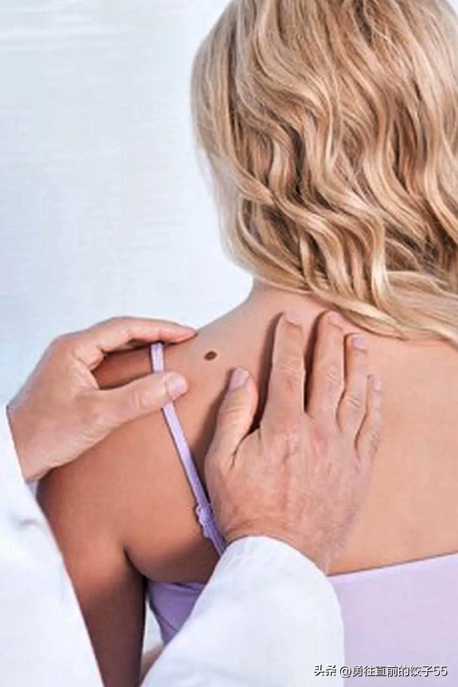 女人身体哪个地方有痣最有福气女人身体特征与命运的关系一直是人们比较关注的话题，因