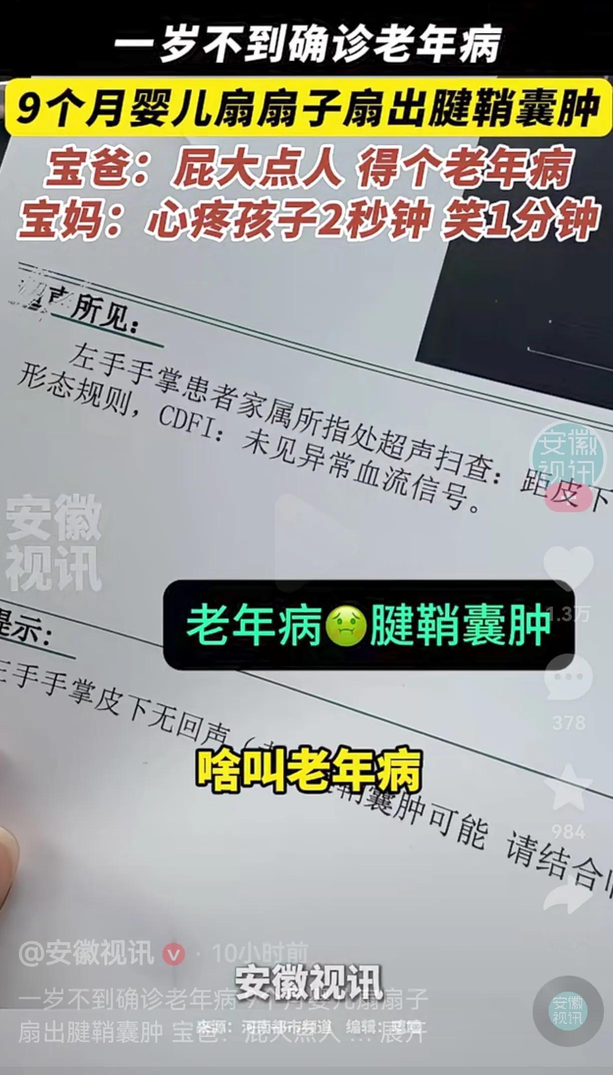 笑不活了！9个月大的婴儿模仿大人扇扇子，扇出了腱鞘囊肿，也就是我们俗称的老年病。