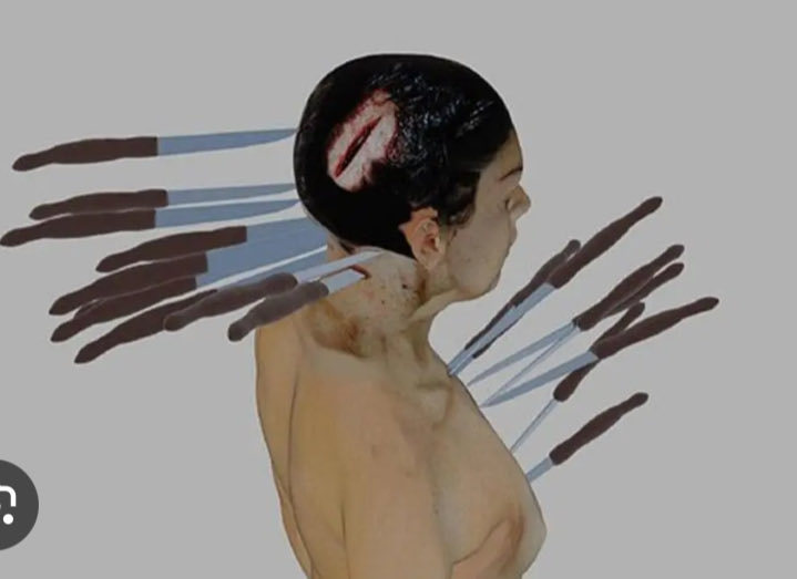 图一：她身中20处刀伤，还有至少11处瘀伤。当局却称她是自杀身亡（CNN）图三：