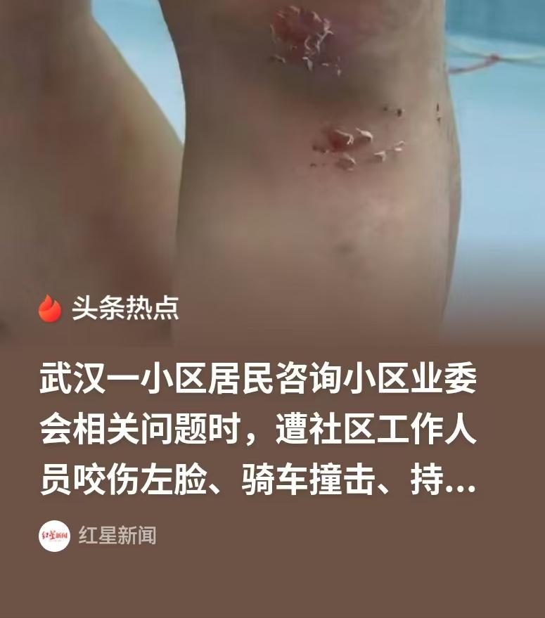 湖北武汉，业委会公布的公共资金使用情况，业主们很质疑，两个代表就去社区询问，结果