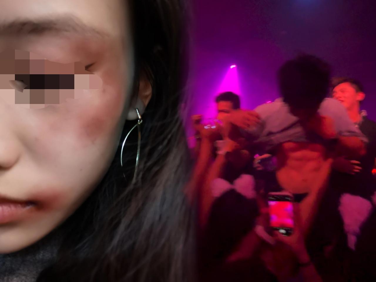 “四位闺蜜KTV庆生点男模
说好600变2000还被打？
这操作简直离谱！原本图