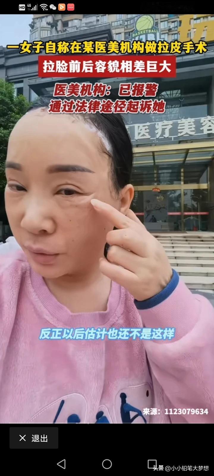 好吓人哦，做医美拉皮做成了这个鬼样！5月5号，湖北孝感，一女子说自己在一家医美机