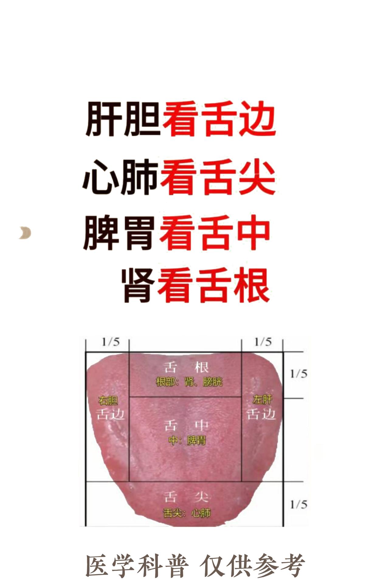 舌象怎么看 中医教你看图学会！