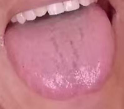 宗筋不振别乱补，根源多在脾肾两虚，中医教你正确调






有不少朋友过了四十