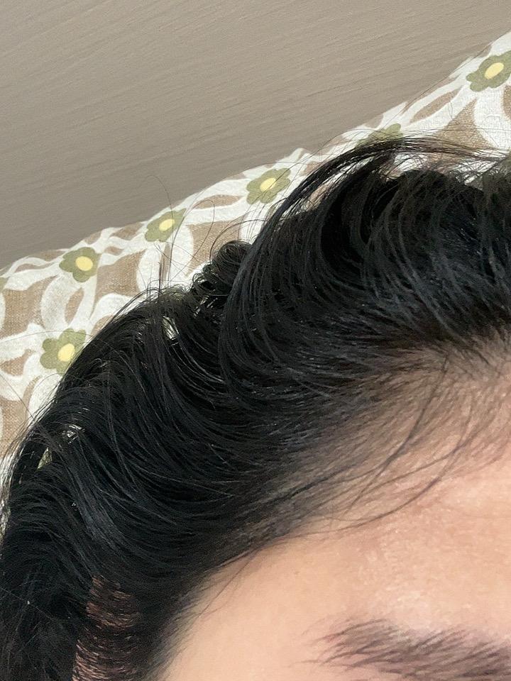 两天不洗头发就好油啊，真的头疼，有没有这种困扰的