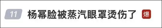 演员杨幂脸被烫伤！网友后怕：再也不敢了