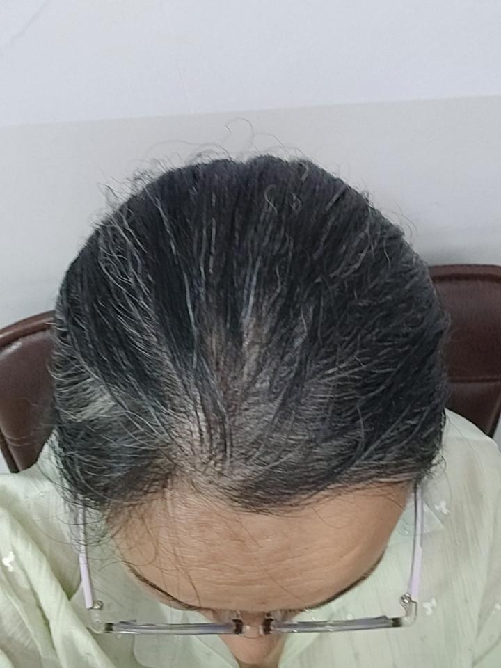 38岁，顶着一头白发去开家长会，我顿悟了！
今天扎起头发去开家长会，后排的妈妈轻