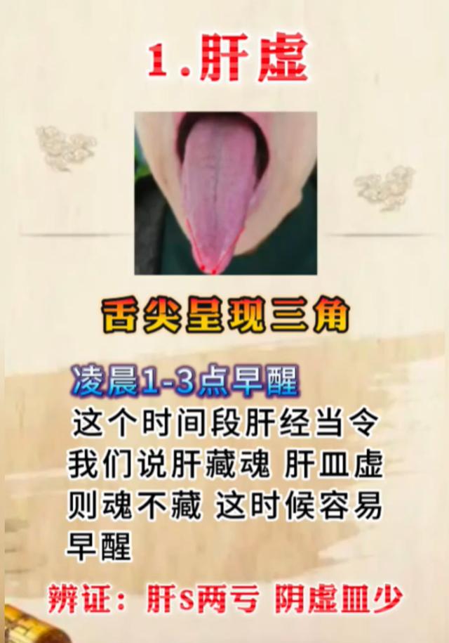 早醒别只当失眠！舌象辨别肝、肺、心脾虚