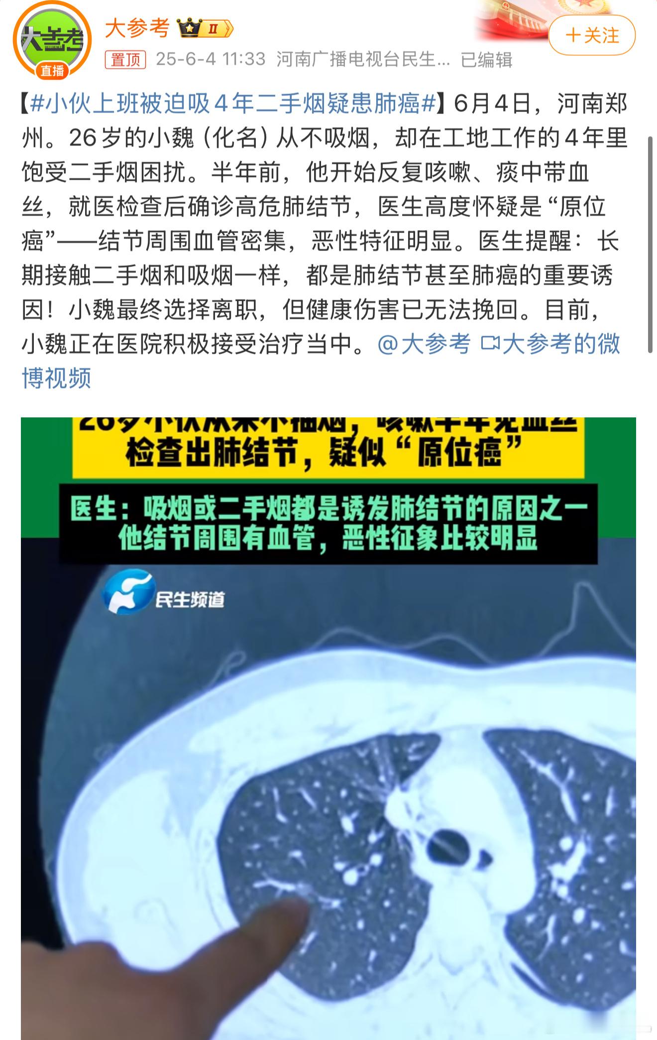 小伙上班被迫吸4年二手烟疑患肺癌不抽烟的人因为吸二手烟得肺癌，太讽刺了，让我想起