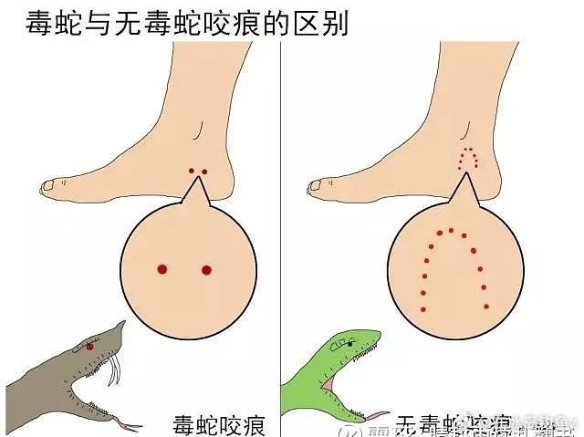广西横州一被蛇咬伤女子不幸离世科技 蛇咬后怎么处理？大家要注意安全被蛇咬后，应立