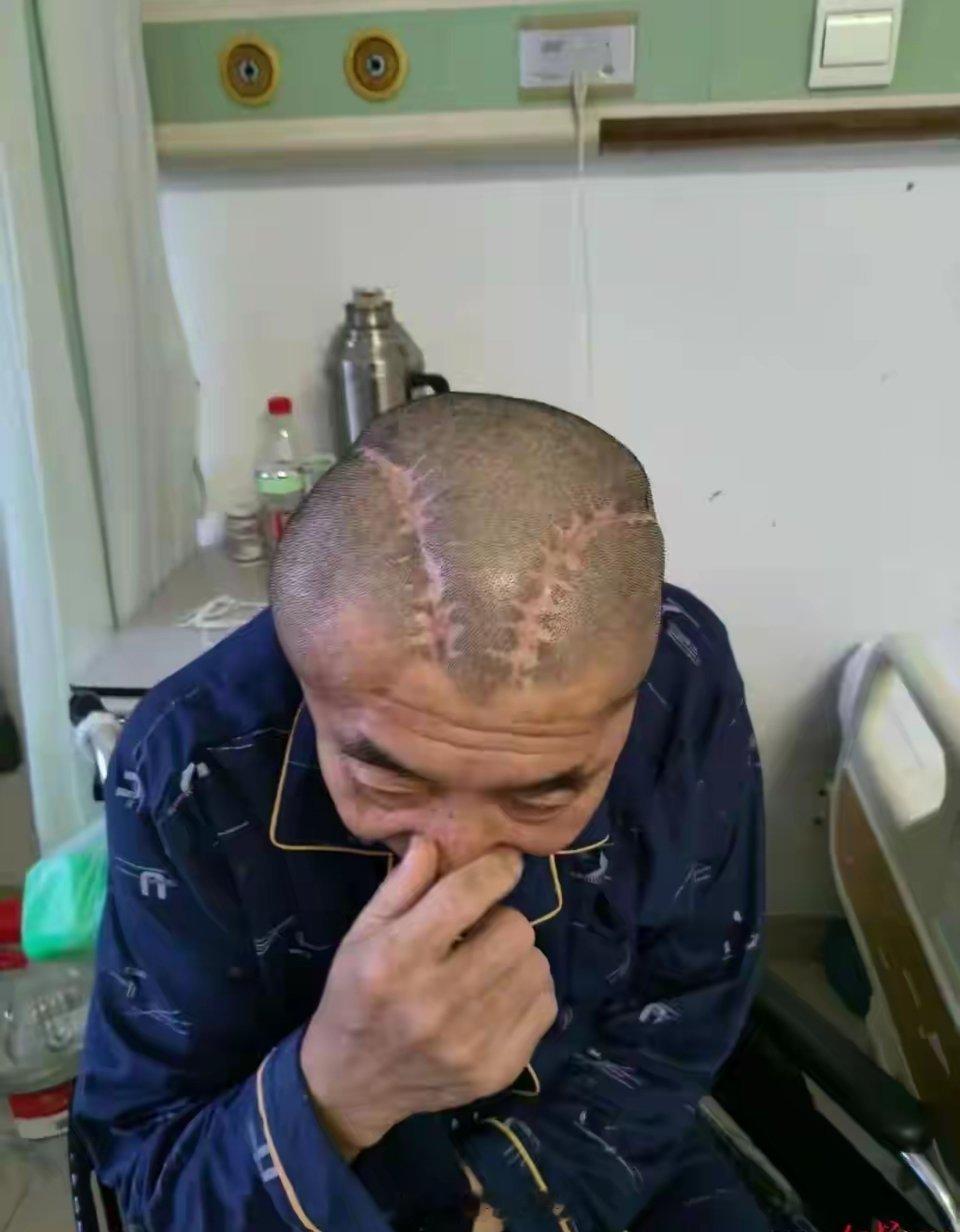 包头市中心医院曾多次被罚一个医生学个医硕博连读七八年，手术台前七八人，连左脑右脑