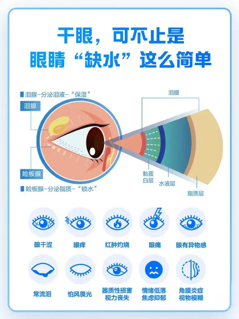 你的眼睛干吗？这份护眼指南请查收！