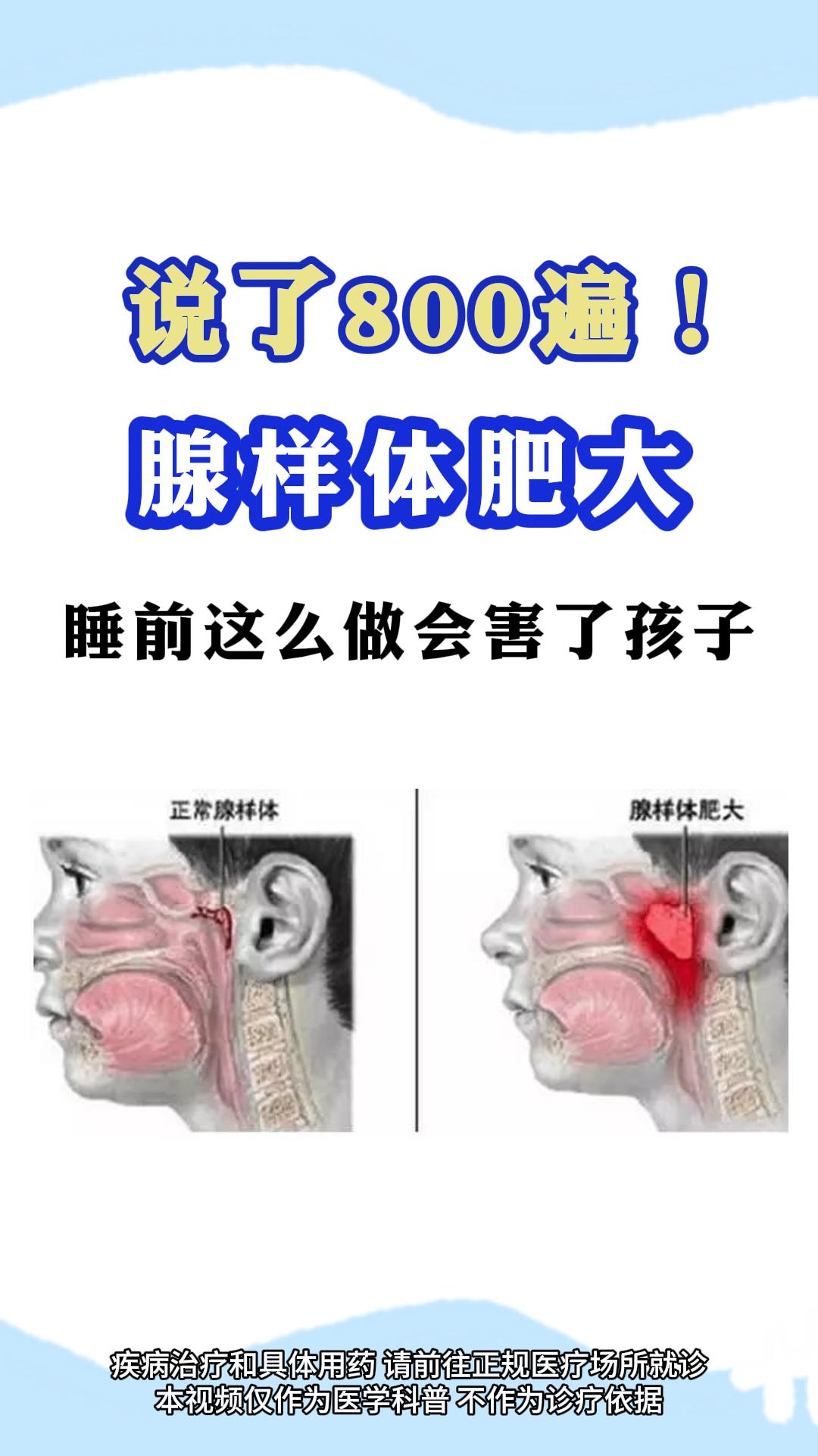 医学科普 育儿 腺样体肥大