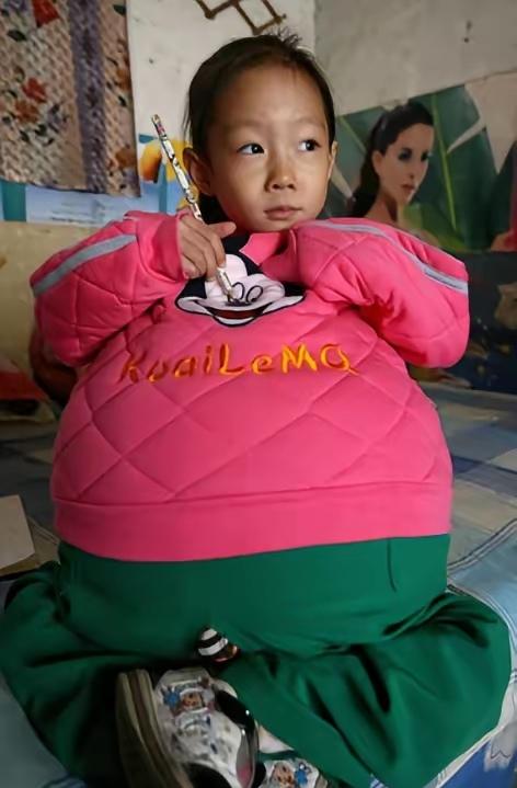 4岁女孩身高不足一米，肚子却大得像个巨型圆球，甚至被医生断言活不过三个月！这可不