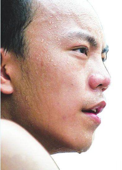 鼻子上汗，头上汗，胸口汗，阴处汗，手心汗，脚心汗……真不一样1，鼻子汗多，肺气虚
