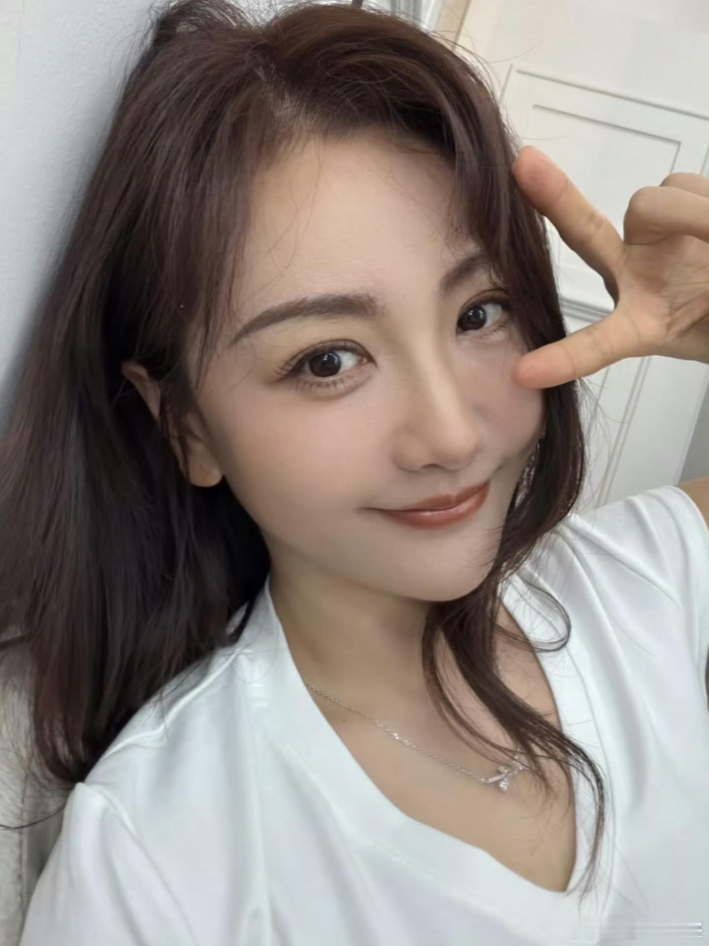 杨蓉面部烫伤恢复近照她好漂亮啊，这点疤也不会影响她的颜值的 