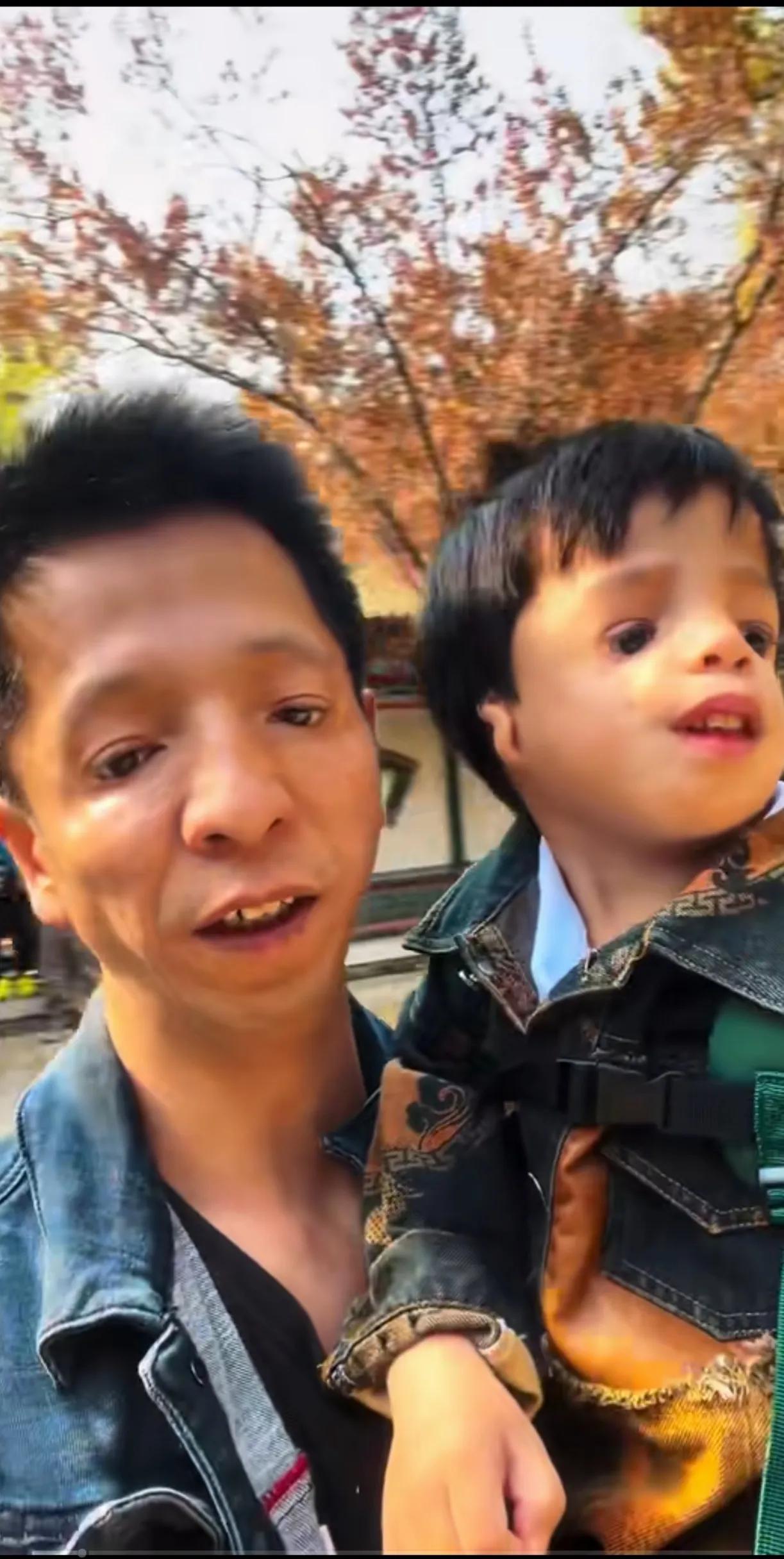 阿凡达的基因太强大了，他儿子吉祥全部遗传到了他的缺陷。
吉祥的头发长得很好，一头