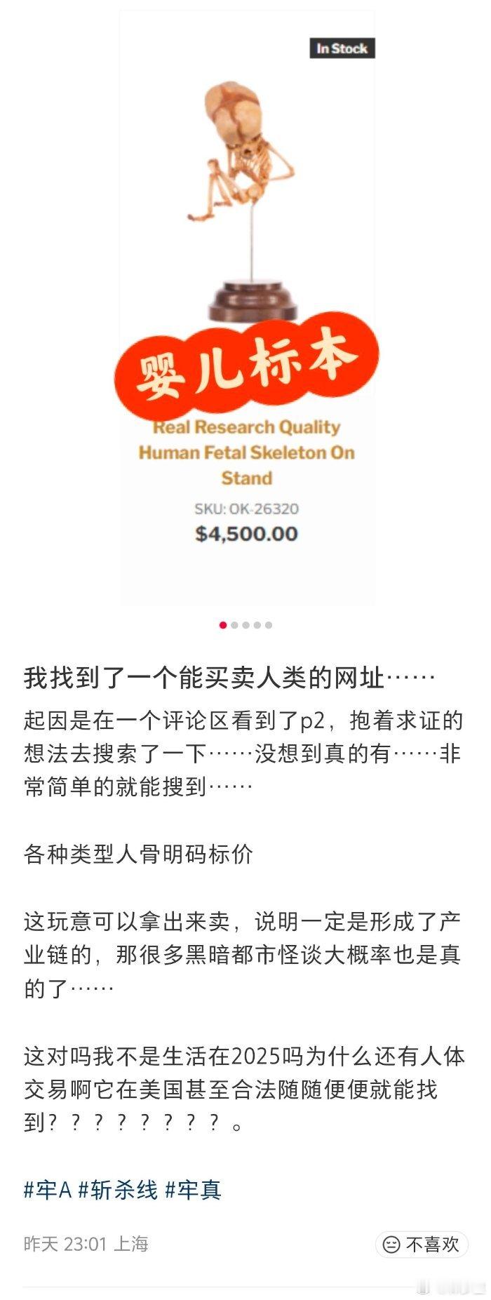 美国买卖真实人骨的网站，随随便便就找到了。所以，美国生物医学的研究总是很有看点，