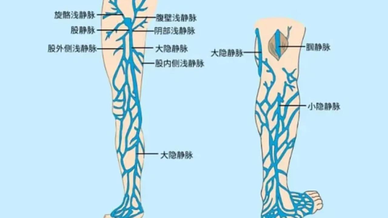 静脉曲张医保手术（剥脱、射频/激光消融）性价比高、技术成熟，那正统CHIVA的存