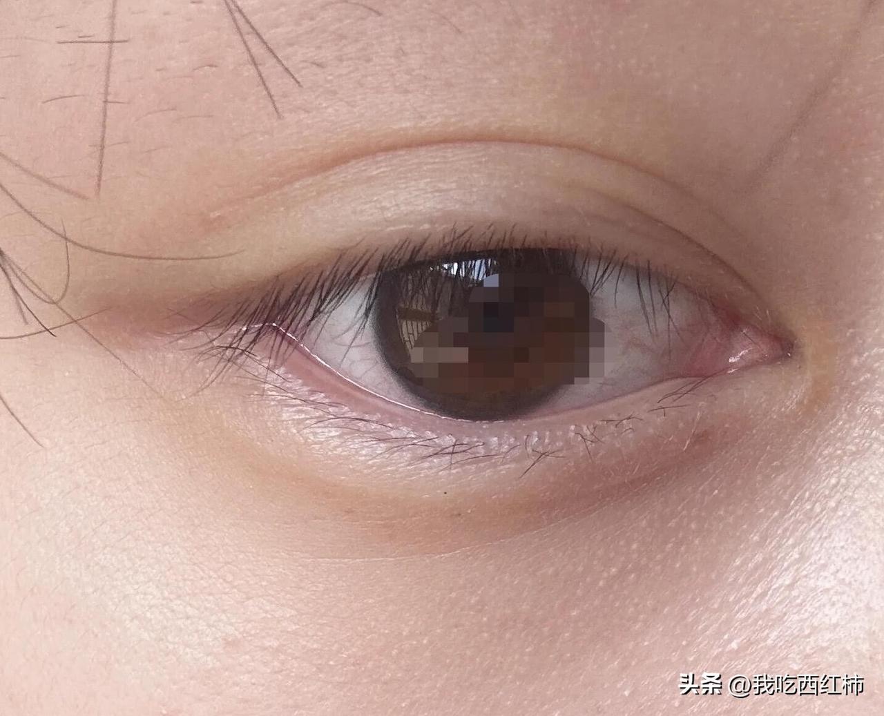 38岁眼部保养心得
很多人问我，为什么到了这个年纪，眼下还没有明显的细纹，看起来