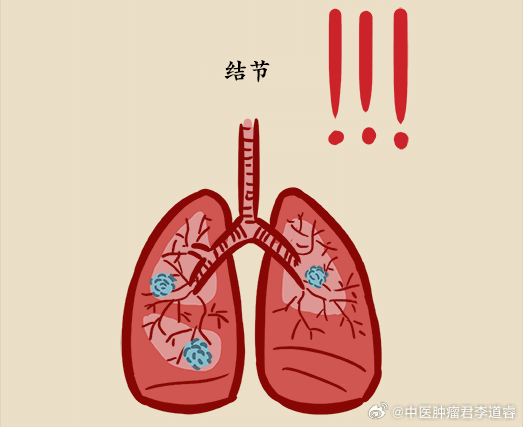 【体检发现 肺结节 要不要手术切除？哪些人群建议定期做肺癌筛查？】 肿瘤防治科普