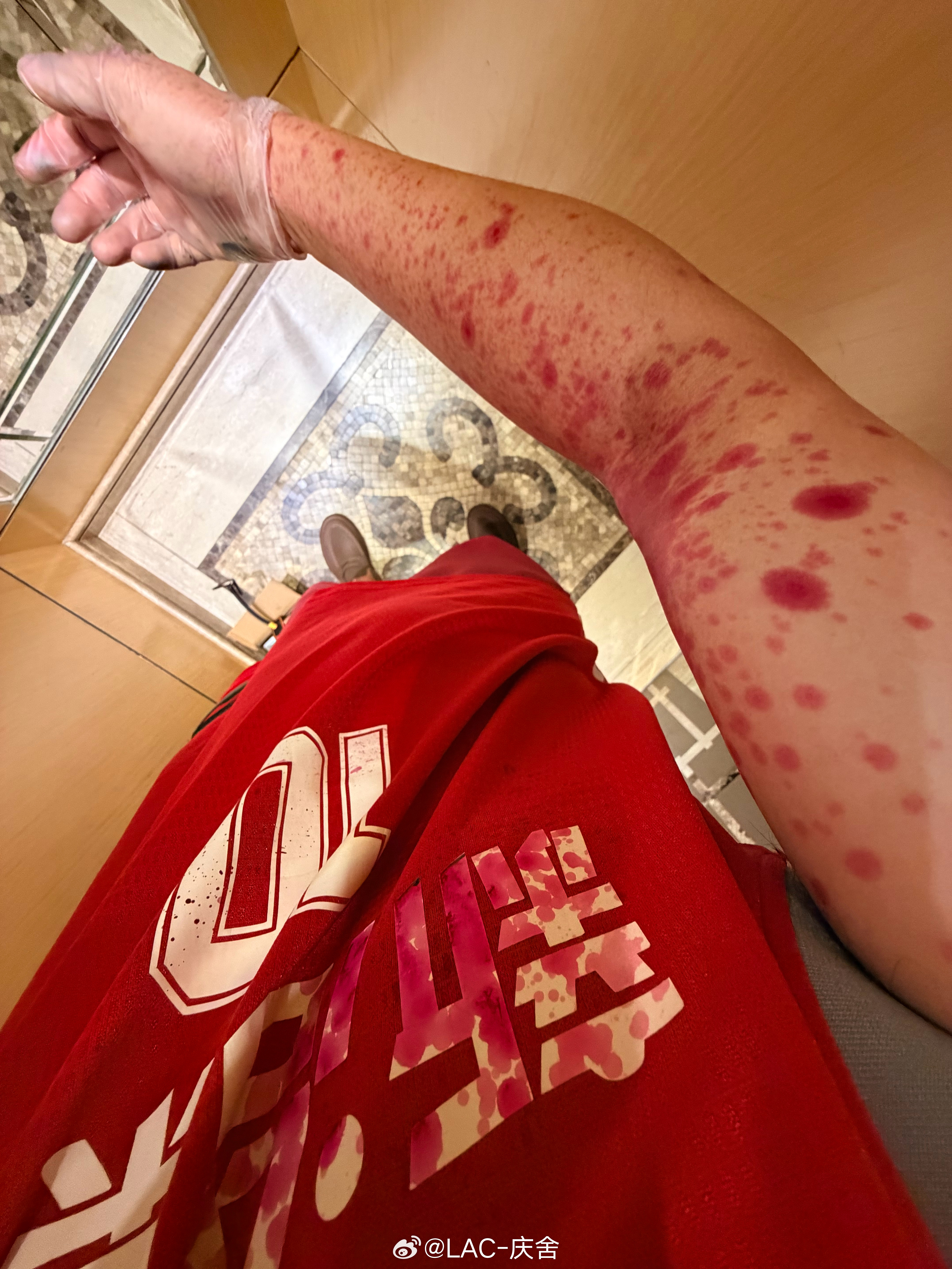 放假在家着急打一份彩色资料结果发现彩色喷头堵了亲自上手治理喷头结果渍我一身这彩色