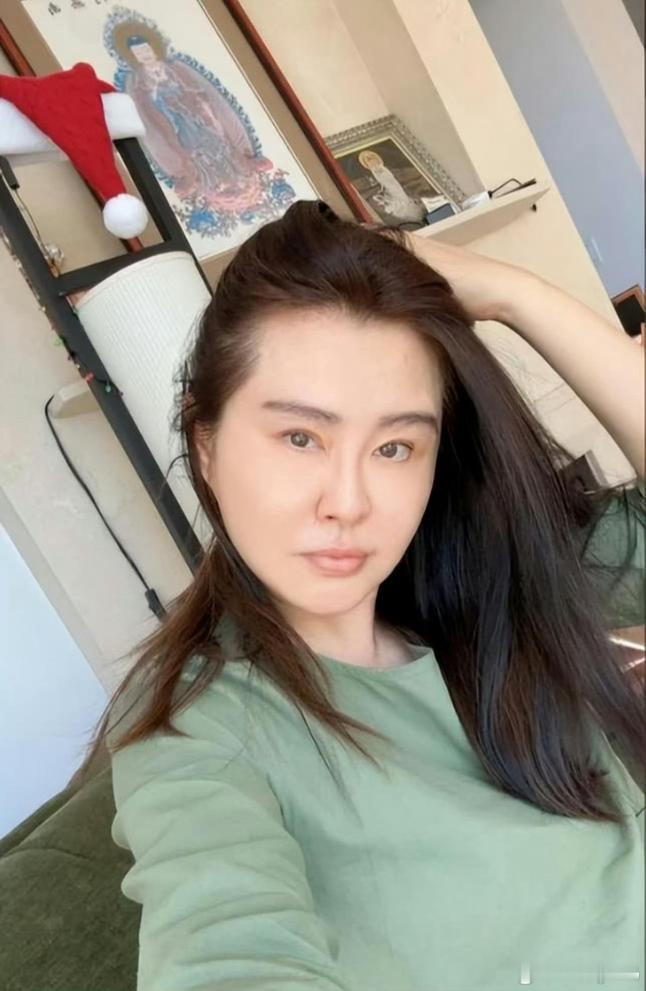 王祖贤医美之前不是脸部 有发生过车祸吗？医美修复也很正常好吧 