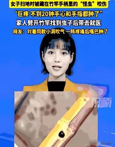 万万没想到！
四川雅安，一位女子在家里扫地时，竟被扫把柄里窜出的一只“怪虫”狠狠
