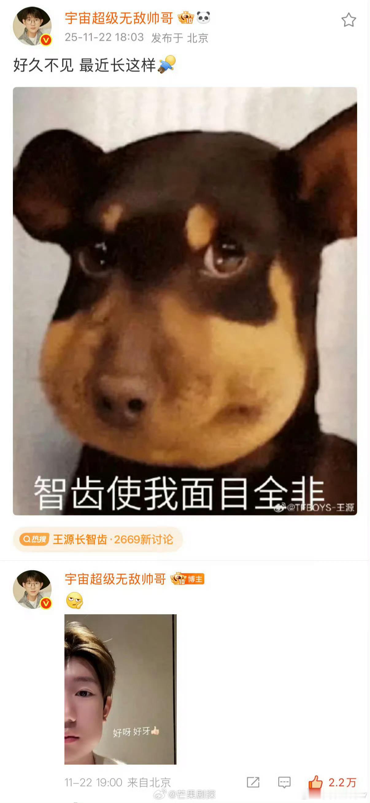 王源语音分享备忘录王源拔智齿时写了一首歌 抖落碎片，王源分享了近期的生活碎片，拔