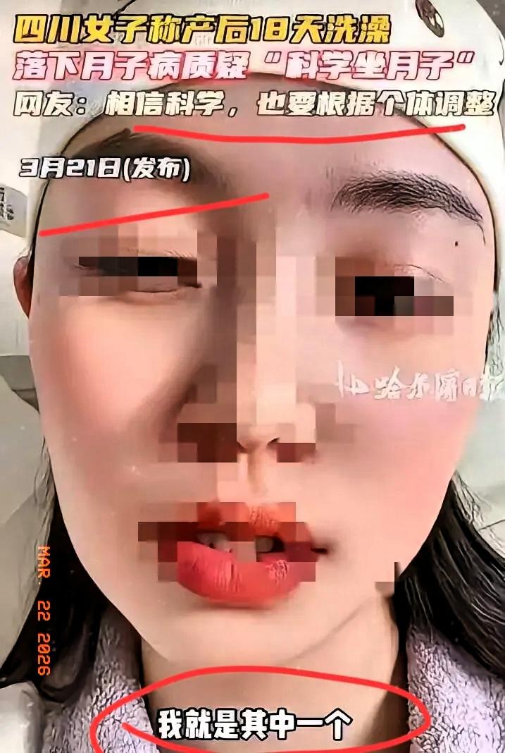 四川女子跟风“科学坐月子”，产后18天洗头洗澡不护头脚，月子后吹风就头疼关节疼。