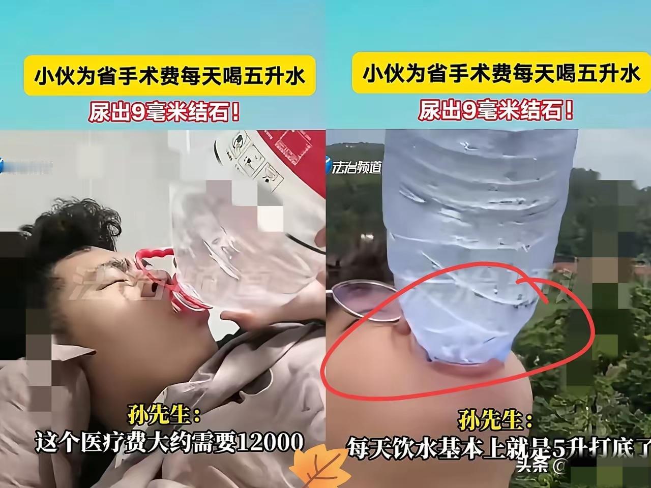 太狠了！

孙先生查出左侧肾有结石，一听手术费约12000元，直接就断了做手术的