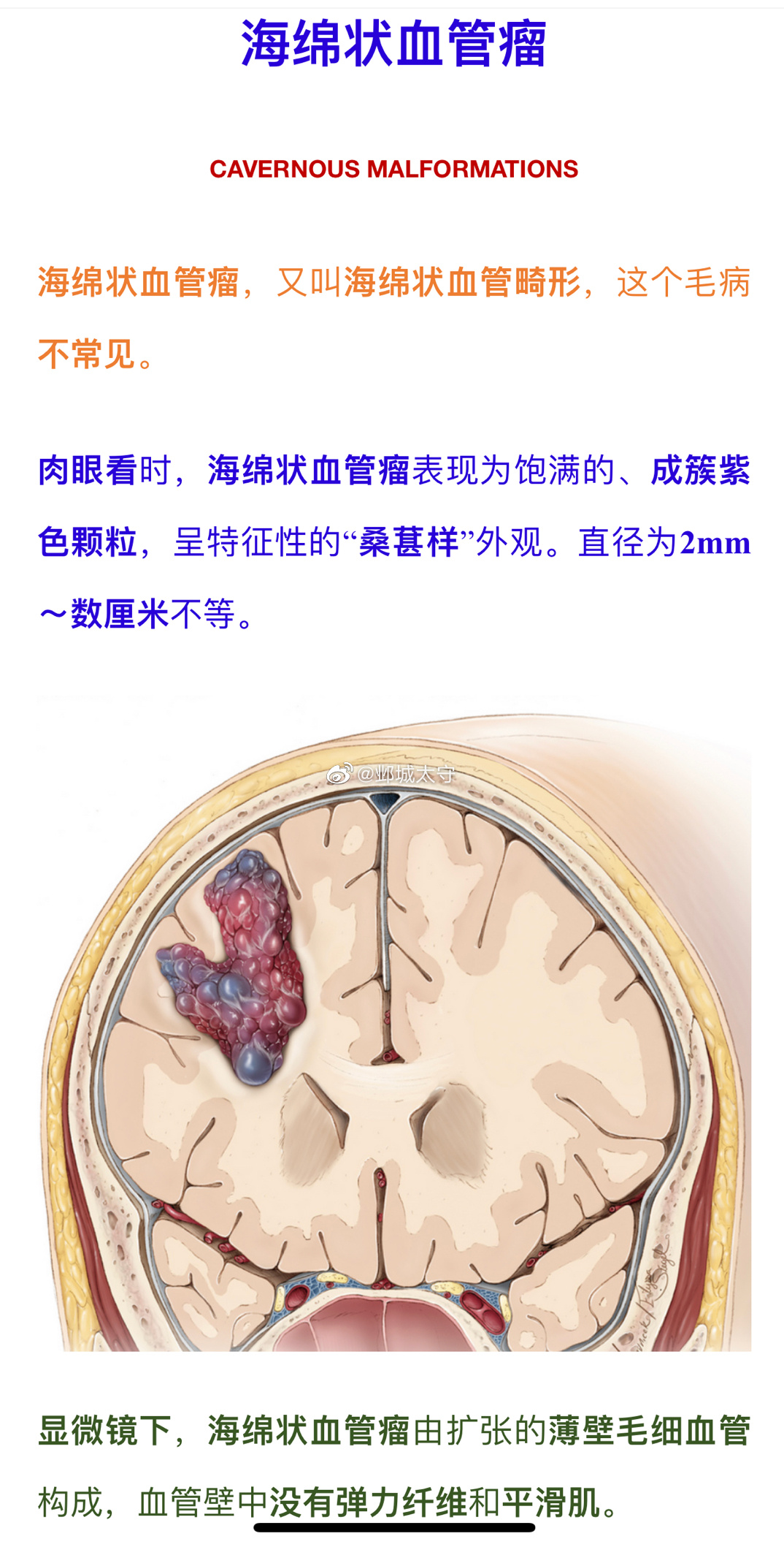 早上有个脑出血出院一周的病人来复诊，他言语不利、肢体不遂等诸症恢复得很好，基本没