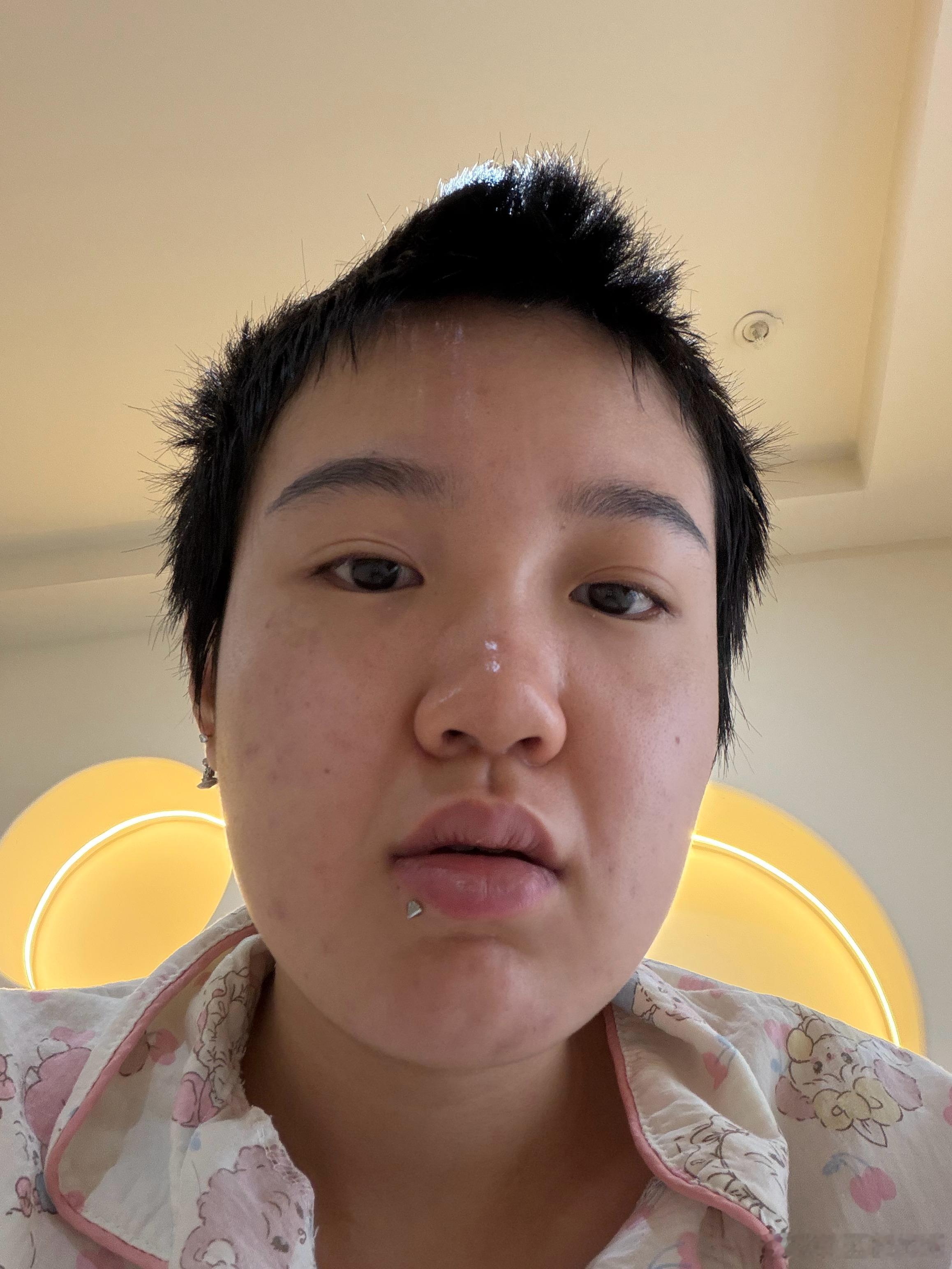 挑战世界第一水肿脸体质 ​​​