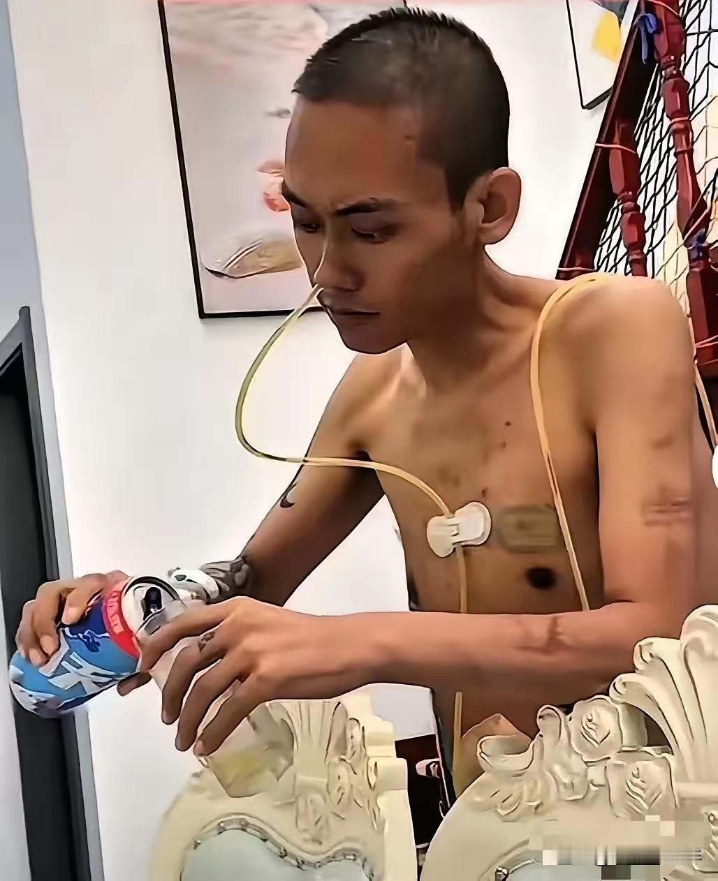 生死看淡！重庆一男子确诊肝癌晚期，放弃治疗后买了一箱啤酒。他浑身插着管子，光着膀