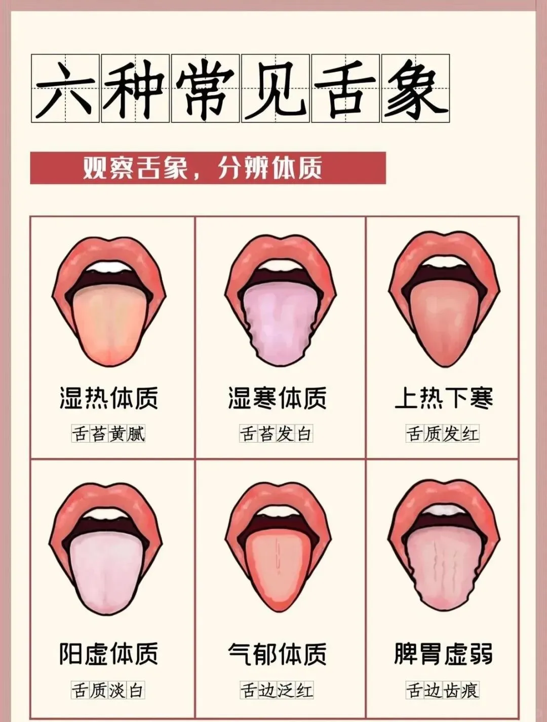 通过舌相看你的体质