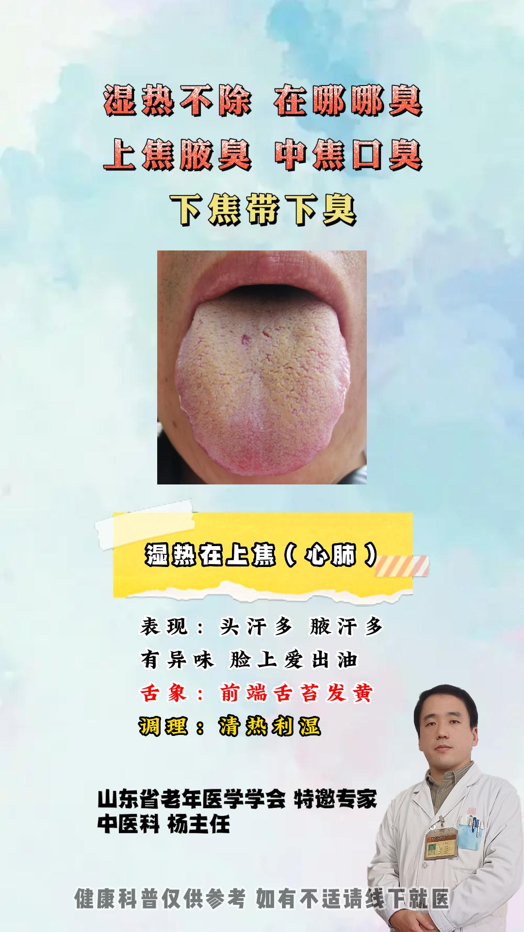 健康科普 湿热 中医科普 涨知识