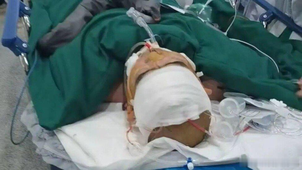 凤凰新闻【3名工人聚餐1人中毒身亡，家属：食堂误把工业酒精当散酒卖】封面新闻记者